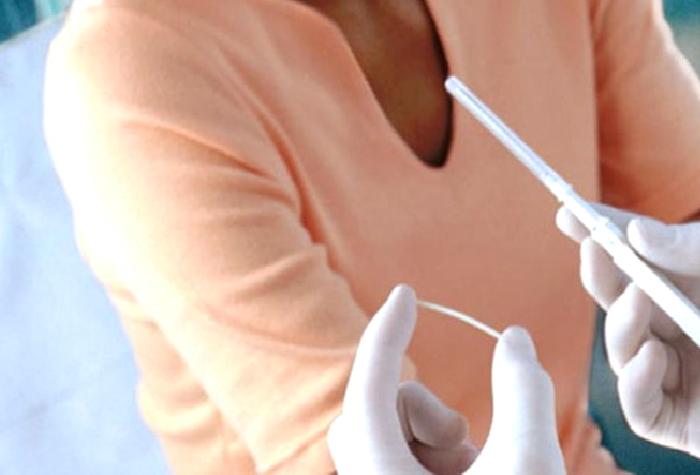 AİLE PLANLAMASI ( DOĞUM KONTROLÜ)