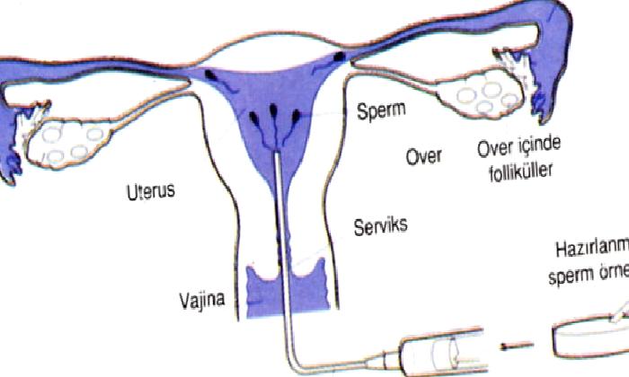 AŞILAMA YÖNTEMİ