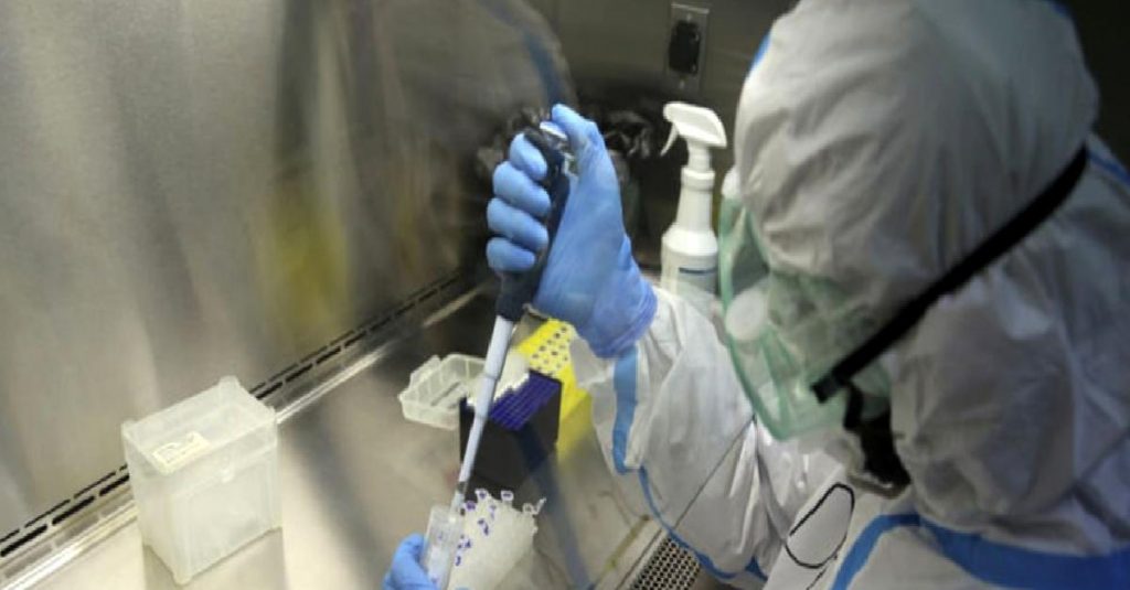 Günlük vaka sayısı 14 bin 933