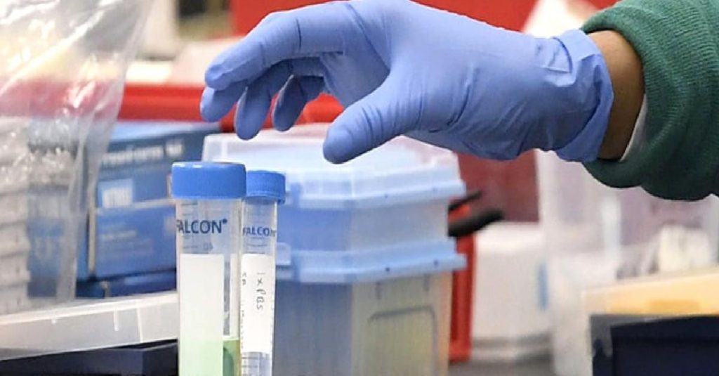 Günlük vaka sayısı 21 bin 354