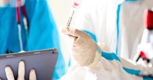 Günlük vaka sayısı 22 bin 345