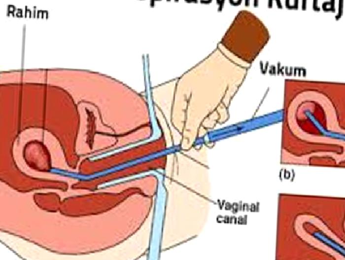 Kadın Doğum Hakkında Bilinmesi Gerekenler – Soru Cevap