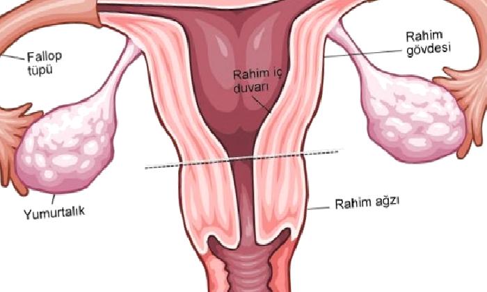 Kadın Genital Sistem Enfeksiyonları ve Cinsel Yolla Bulaşan Hastalıklar