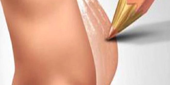 KİMYASAL GEBELİK NEDİR? BELİRTİLERİ NELERDİR?