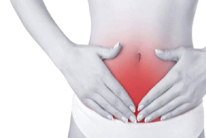 KRONİK PELVİK AĞRI