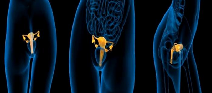 Laparoskopi Nedir?