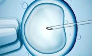Mikroenjeksiyon (ICSI) İşlemi Nedir?