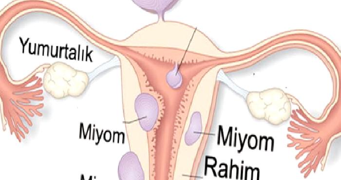 MYOMLAR ..