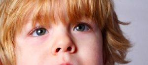 Otizm Spektrum Bozukluğu