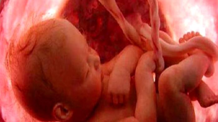 PRENATAL GENETİK TANI TESTLERİ