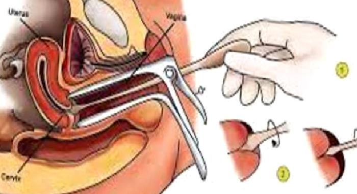 RAHİM AĞZI KANSERİ TARAMA TESTLERİ