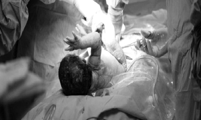 SEZARYEN İLE DOĞUM