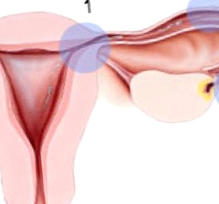 TÜPLERİN TIKALI OLMASI