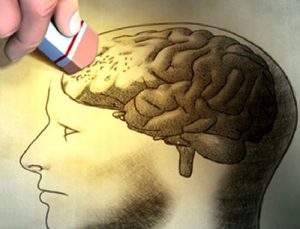 UNUTTUĞUNU UNUTMAK: ALZHEIMER