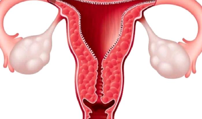 лапароскопия