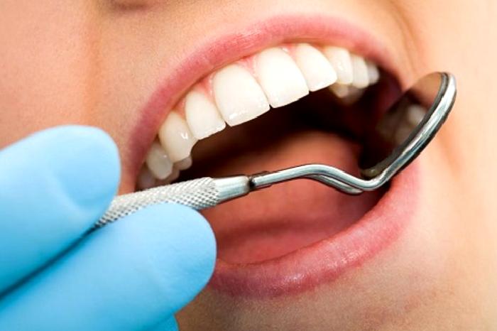 20’lik Diş Nedir? Yirmilik Diş Ağrısı Nasıl Geçer? 20 Yaş Ameliyatı Nasıl Yapılır?