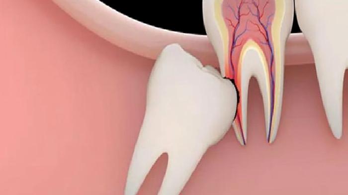 Ağız Diş ve Çene Cerrahisi