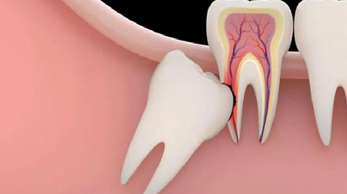 Ağız, Diş ve Çene Cerrahisi Nedir?