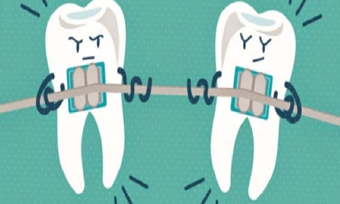 AĞIZ DIŞI APAREYLER