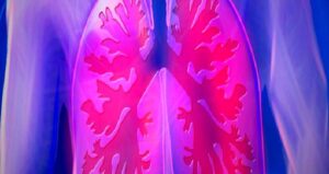 Akciğer Sönmesi