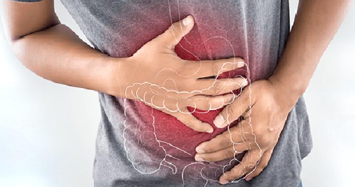 Akıllı Mide Balonu Sıkça Sorulan Sorular