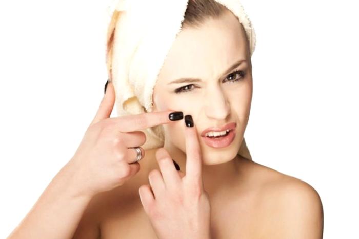 Akne (Sivilce) ve Akne Tedavisi