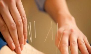 AKUPUNKTURUN TEDAVİDEKİ ETKİSİ KALICI MIDIR?