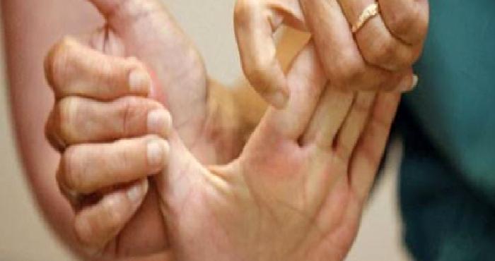 Akut Eklem Romatizması (Romatizmal Ateş)