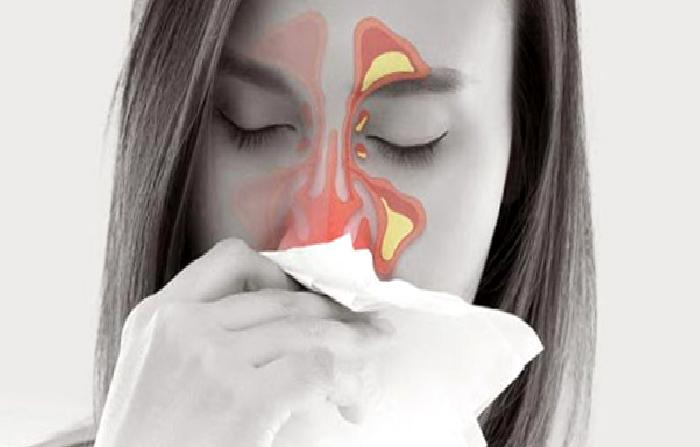 Alerjik Burun Hastalıkları