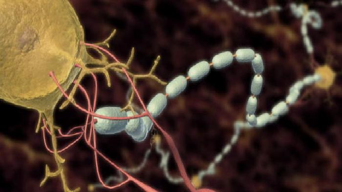 ALS (Amyotrofik Lateral Skleroz)