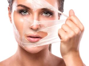 Altın İğne Uygulaması