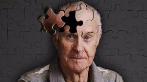 Alzheimera karşı Refleks Terapi