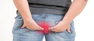 Anal Bölge Hastalıkları