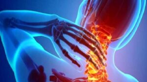 Ankilozan spondilit (Omurgayı etkileyen Romatizma Hastalığı)