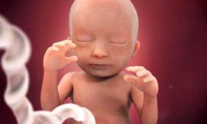 ANTENATAL HİDRONEFROZ