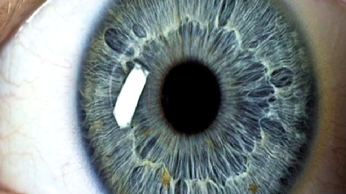 Astigmat Nedir?