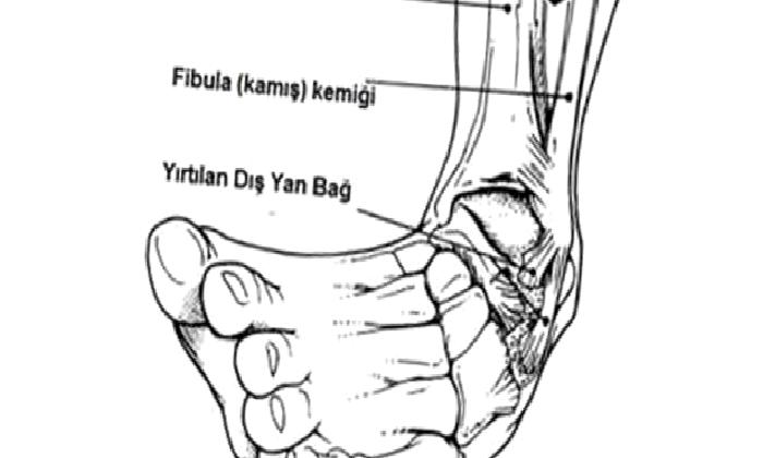 AYAK BİLEĞİ KIKIRDAK YARALANMALARI