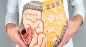 Bağırsak Korunması