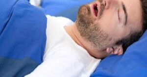 Barbed Stich Anterior Platoplasti Tedavisi