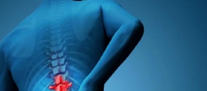 Bel Ağrısı ve Bel Fıtığı