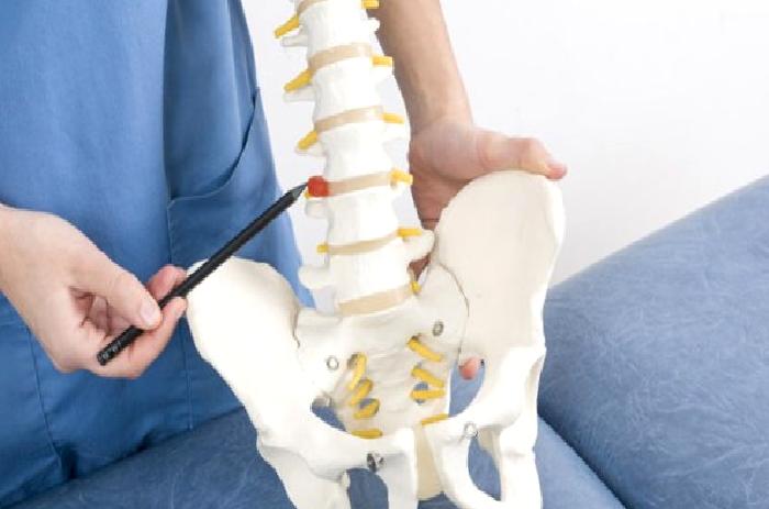 Bel Fıtığı Patlaması