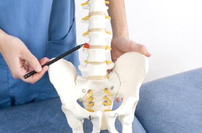 Bel Kayması Nedir ve Tedavisi Nasıldır?