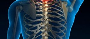 Bel ve Boyun Ağrıları
