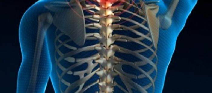 Bel ve Boyun Ağrıları