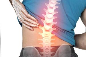 Belde Dar Kanal Nedir? Nasıl Teşhis Edilir? Tedavisi Nasıldır?