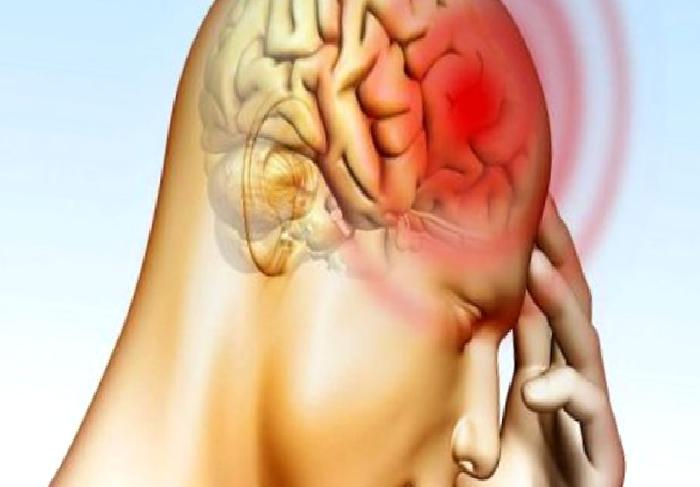 Beyin Baloncuk Ameliyatı