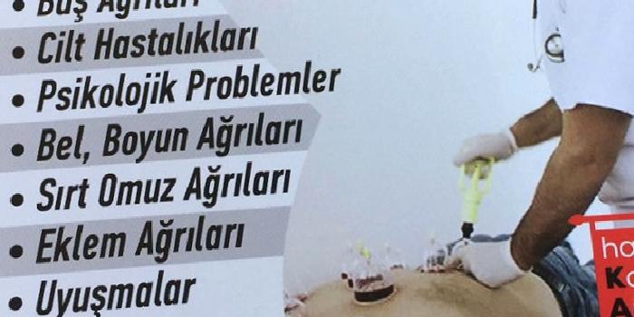BİR KAT(KORUNMA,ARINMA,TEDAVİ) YÖNTEMİ OLARAK HACAMAT;