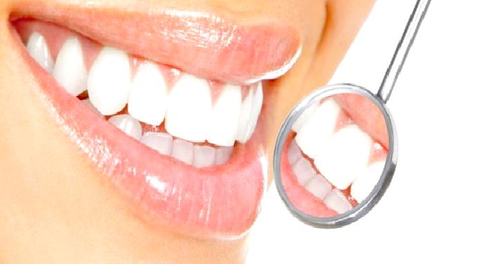 Bleaching (Lazer Beyazlatma)