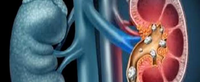 Böbrek Nakli: Bağışıklık Sistemi ve Corona Enfeksiyonu