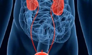 Böbrek Taşları’ndan Korunmak İçin..